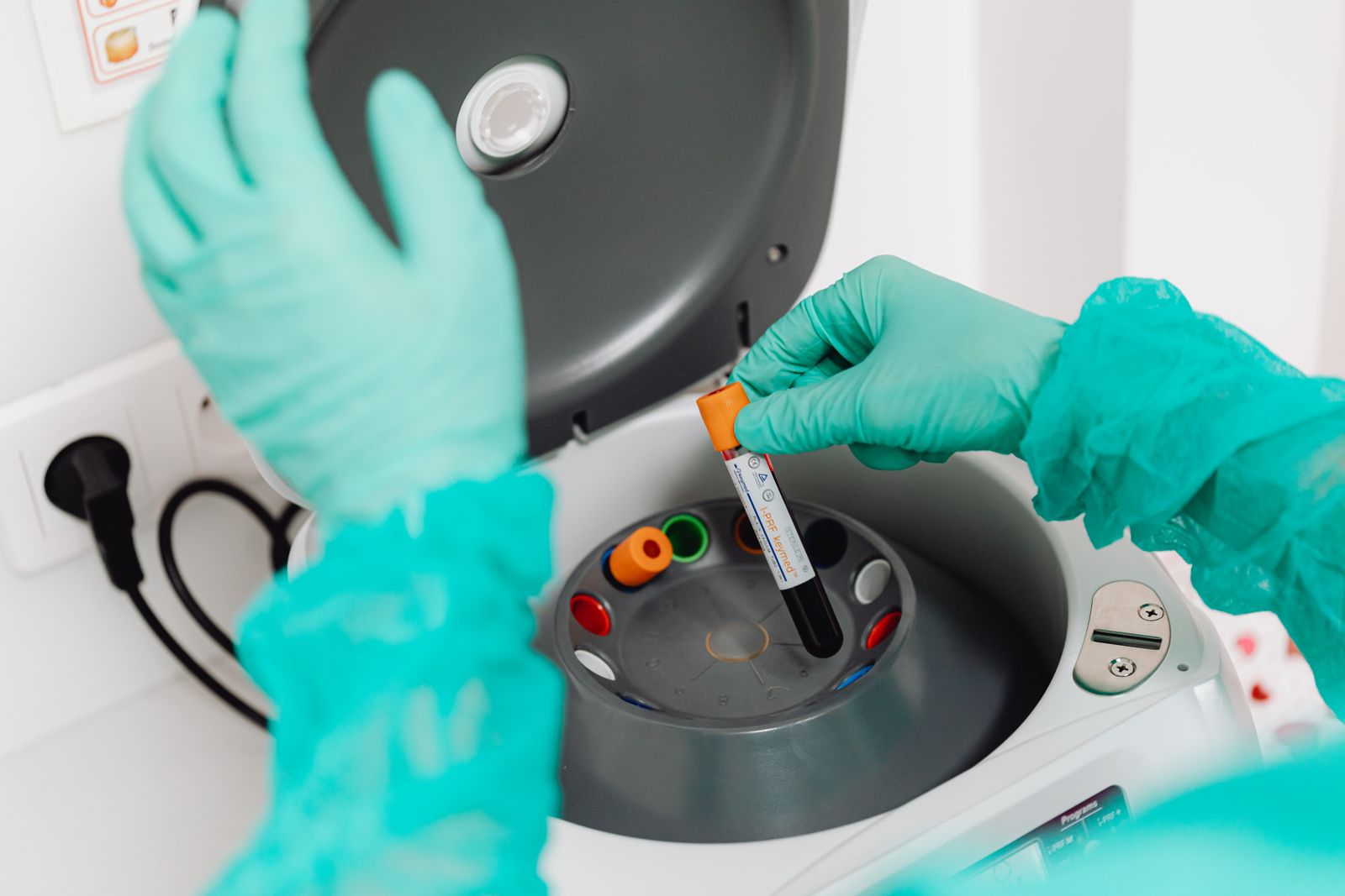 On-site lab services at Riverbend Family Medicine