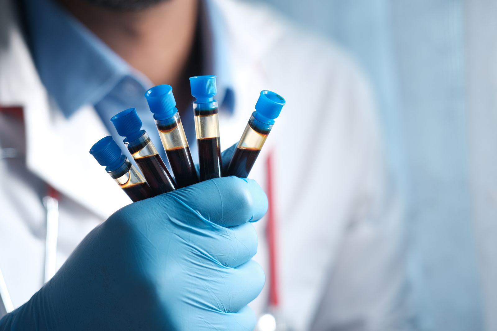 Close-up of a medical technician holding several blood samples in test tubes, highlighting healthcare.